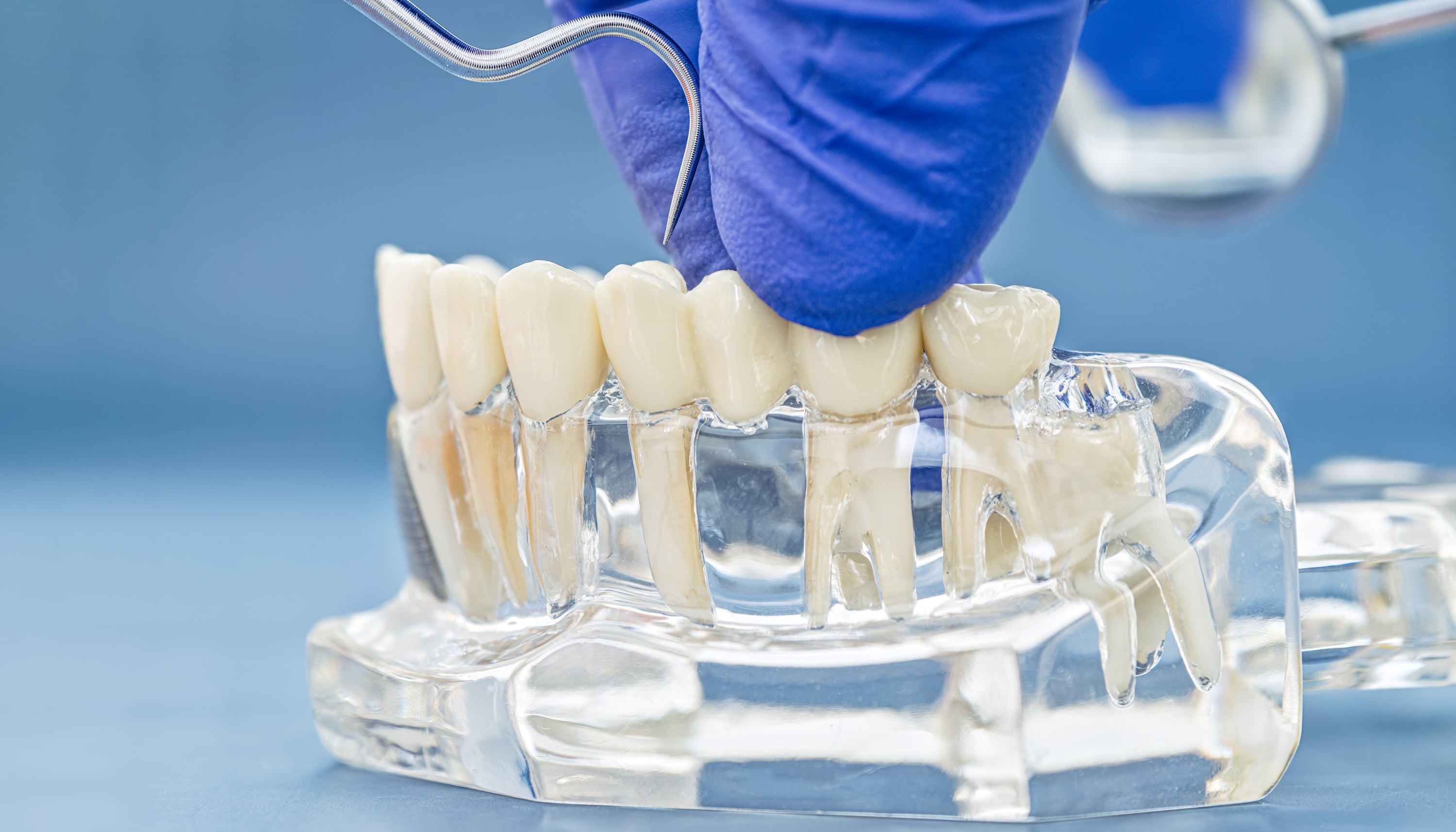Dentist and patient reviewing crown and bridge options on a tablet