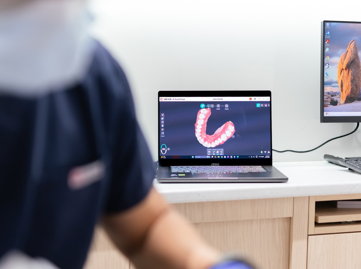 Close-up of an Invisalign clear aligner tray at Joyner Family Dental