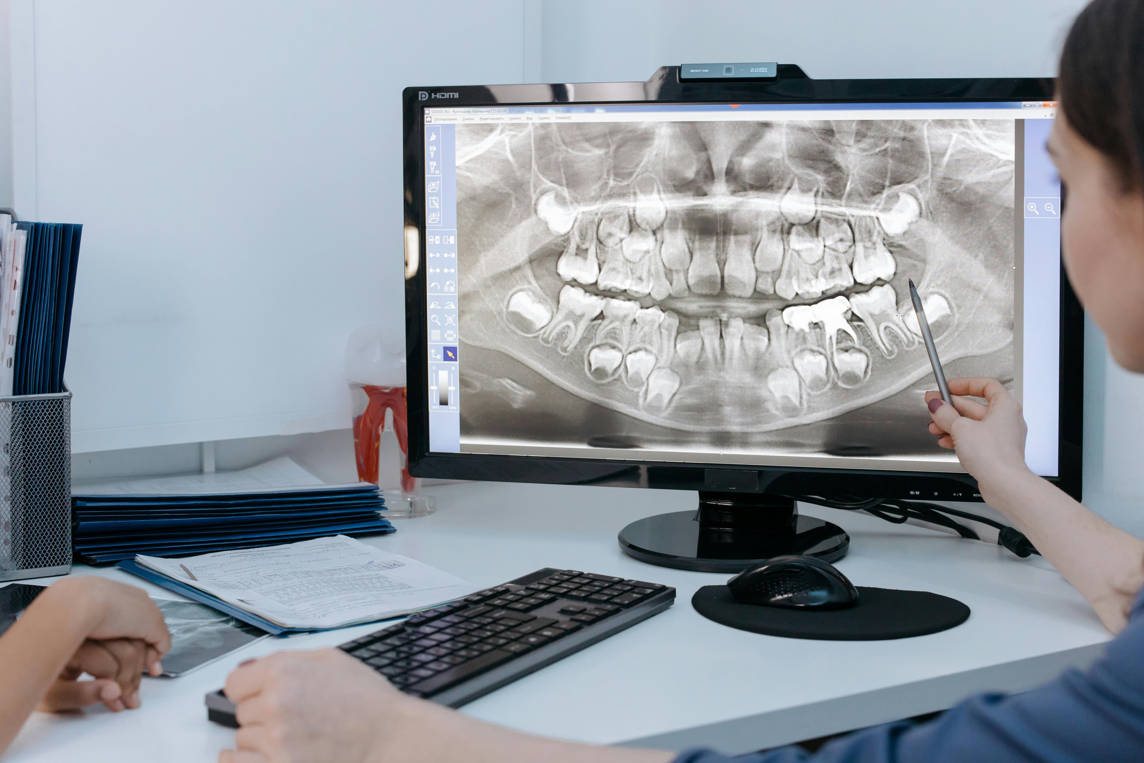 Digital X-ray and CBCT imaging showing root canal anatomy at Joyner Family Dental